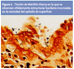 Figura 1. Tinción de Warthin-Starry en la que se observan nítidamente estructuras bacilares incurvadas en la vecindad del epitelio de superficie