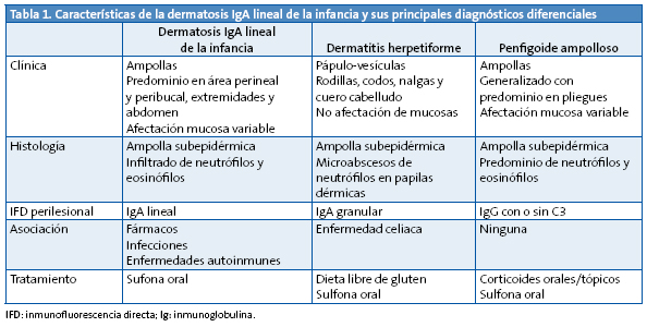 Tabla 1. Características de la dermatosis IgA lineal de la infancia y sus principales diagnósticos diferenciales