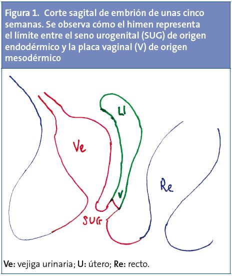Figura 1. Corte sagital de embrión de unas cinco semanas. Se observa cómo el himen representa el límite entre el seno urogenital (SUG) de origen endodérmico y la placa vaginal (V) de origen mesodérmico