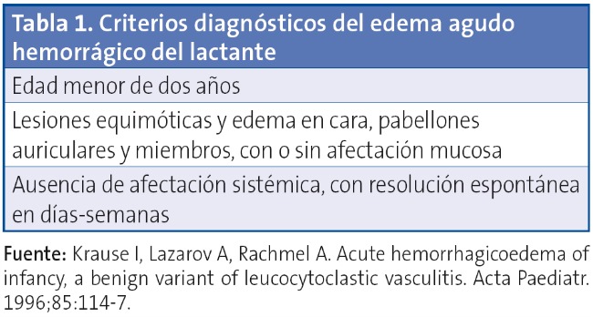 Tabla 1. Criterios diagnósticos del edema agudo hemorrágico del lactante