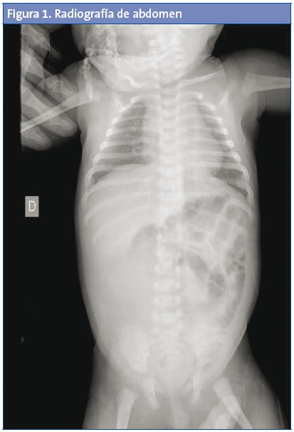 Figura 1. Radiografía de abdomen.
