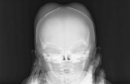 Figura 2. Radiografía craneal
