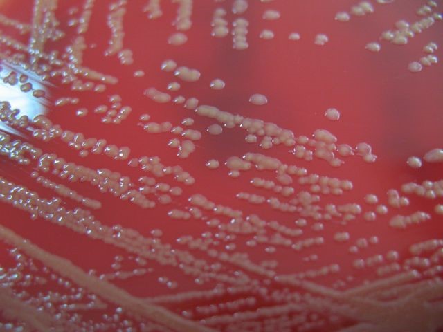 Figura 1. Pantoea agglomerans. Cultivo agar sangre: colonias mucosas de color amarillo