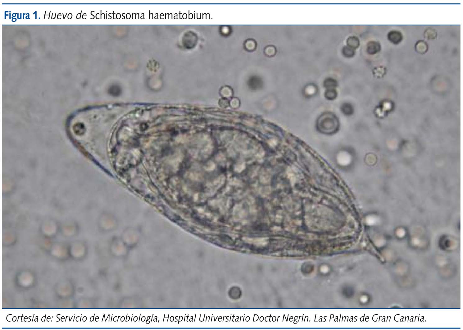 Figura 1. Huevo de Schistosoma haematobium.