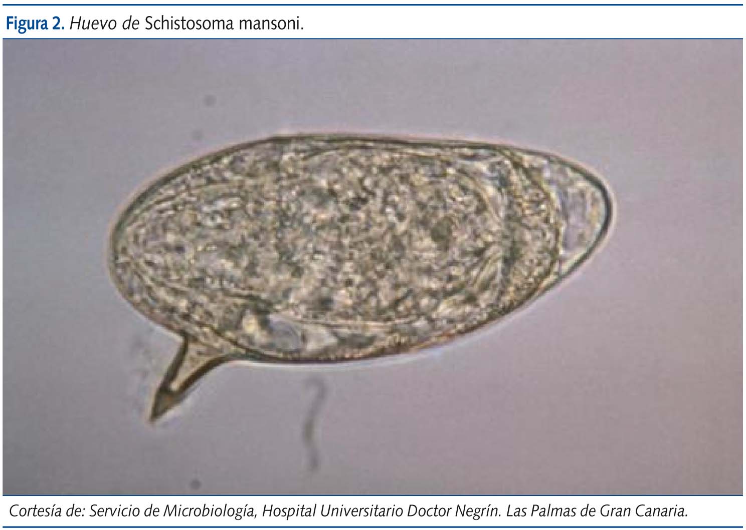 Figura 2. Huevo de Schistosoma mansoni.