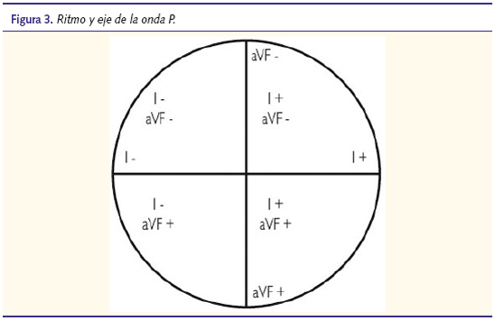 Figura 3. Ritmo y eje de la onda P